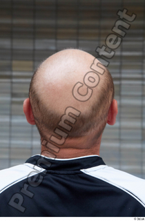 Street  673 bald head 0002.jpg